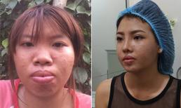 Lộ ảnh mặt mộc sau khi thẩm mỹ của 'Thị Nở lột xác'