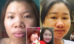Màn lột xác của hai 'Thị Nở' gây xôn xao nhất mạng xã hội