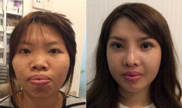 Hành trình làm đẹp của cô gái bị chê ‘chuột chù’