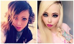 Cô gái 30 tuổi chi gần 800 triệu đồng để phẫu thuật giống búp bê Barbie