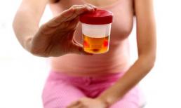 Những dấu hiệu âm thầm của ung thư bàng quang mọi phụ nữ cần biết