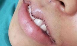 Đây là xu hướng làm đẹp đang mê hoặc chị em châu Á