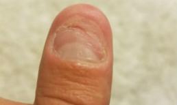 Thói quen cắn móng chứng minh bạn là người cầu toàn và có nhân cách tốt