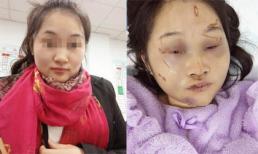 Số phận trớ trêu của cô gái xinh đẹp yêu luôn kẻ hiếp dâm mình