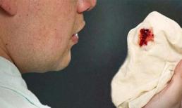 Những triệu chứng ung thư giai đoạn đầu mà 90% mọi người thường bỏ qua