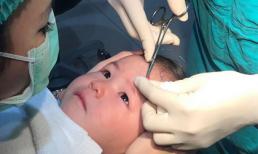 'Thanh niên cứng' tí hon quyết không rơi nước mắt dù bị khâu sống vết thương trên trán