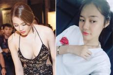 Bất ngờ trước hình ảnh mới 'gầy sọp' của Linh Chi