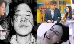 Hình ảnh bầm dập đến 'thân tàn ma dại' của loạt người đẹp châu Á bị bạo hành