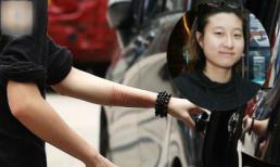 Sau tin đồn tự tử, con rơi của Thành Long xuất hiện với nhiều vết rạch tay 