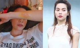 Bị tai nạn bỏng rộp tay, Hồ Ngọc Hà cầu cứu mọi người