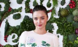 Miranda Kerr tiết lộ bí quyết làm đẹp bằng đỉa
