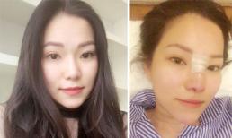 Sau ly hôn, vợ cũ Lâm Vinh Hải quyết định phẫu thuật thẩm mỹ để xinh đẹp hơn