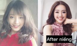 Quá trình niềng răng đau đớn của 'bản sao' Tâm Tít ở The Face 2017