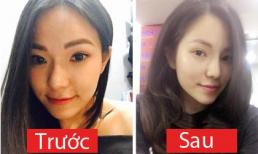 Vợ cũ của Lâm Vinh Hải khoe nhan sắc sau phẫu thuật thẩm mỹ 