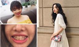 Hot girl và hot boy Việt 1/7/2017: 'Thị Nở tái sinh' trước và sau làm răng, Châu Bùi nữ tính hơn khi chia tay