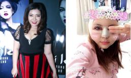 Á quân The Voice mùa đầu tiên công khai gương mặt đỏ tấy, sưng húp vừa 'đập đi làm lại'