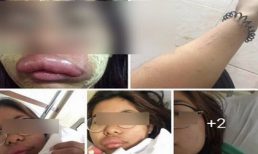 Cô gái xinh đẹp nhận cái kết đắng khi điều khiển xe máy không đội mũ bảo hiểm