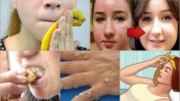 Bạn sẽ tiếc hùi hùi vì biết những lợi ích của vỏ chuối quá muộn