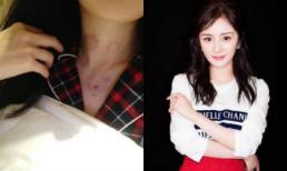 Thực hư chuyện Dương Mịch lộ 'dấu hôn' trên cổ