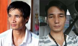 Cận cảnh gương mặt của Lệ Rơi sau khi phẫu thuật thẩm mỹ