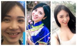 Chỉ nhận chỉnh răng, khán giả vẫn khó lòng tin Thanh Bi không thẩm mĩ vì hình ảnh này