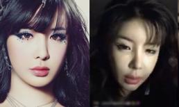 Gương mặt ngày càng biến dạng của 'thảm họa thẩm mỹ' Park Bom