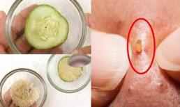 Chấm 1 lát dưa chuột vào đĩa đường rồi chà lên mũi, mụn đầu đen tự khắc 'ngoi' lên