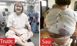 Ngô Thủy Tiên hớn hở khoe ảnh sau khi hút mỡ toàn thân đầy ghê rợn