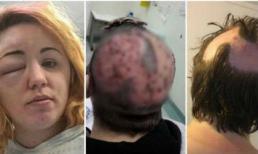 Tự tay nhuộm tóc, người phụ nữ đã đau đớn tột cùng khi nhận kết quả tồi tệ xảy ra với mình