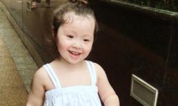 Cadie ra dáng thiếu nữ, hớn hở khi được đi dạo trong công viên