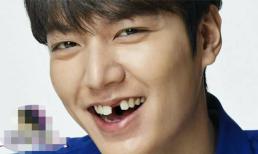 Bật cười trước loạt ảnh mỹ nam xứ Hàn trở thành 'oppa răng sún'