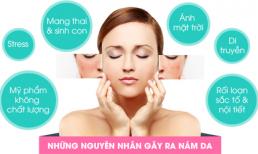Nám da – Phòng bệnh còn hơn chữa bệnh
