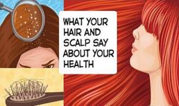 Đoán bệnh cơ thể qua biểu hiện bất thường của tóc cực chuẩn