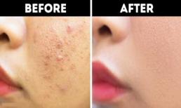 Đừng nằm ườn ra đấy mà mơ da trắng tóc đẹp, hãy đứng lên thử ngay những công thức này đi!