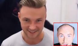 Bí quyết trở thành 'soái ca vạn người mê' trong tích tắc dành cho chàng hói