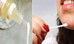Tuyệt chiêu trị mụn trứng cá chỉ bằng 1 lọ thuốc nhỏ mắt