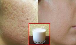 Lỗ chân lông to như đầu tăm cũng se khít khịt, da mịn không tỳ vết chỉ với túi sữa vài nghìn đồng!