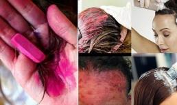 Nhuộm tóc thường xuyên có thể gây ung thư: 90 % phụ nữ chưa hiểu hết tác hại của việc làm đẹp này