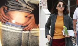 Selena Gomez lần đầu xuất hiện sau khi tiết lộ chuyện ghép thận