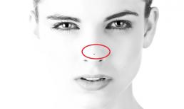 Sở hữu 3/8 nốt ruồi này, bạn chắc chắn có cuộc sống giàu sang, phú quý, của cải ăn cả đời không hết