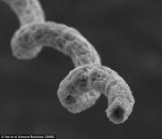 Dùng robot siêu nhỏ để tiêu diệt từng tế bào ung thư trong cơ thể