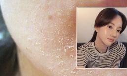 Cách rửa mặt để có làn da căng mướt láng mịn như gái Hàn, gái Nhật 