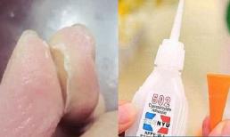 Mẹo hay xử lý khi bị keo 502 dính vào tay cực nhanh, an toàn