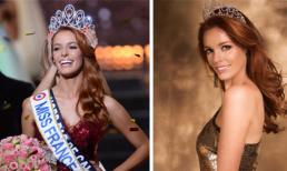 Tân Hoa hậu Pháp 2018 mặt đầy nếp nhăn dù mới 23 tuổi