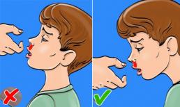Sai lầm lúc sơ cứu: Chảy máu mũi ngửa mặt lên, hút nọc độc sau khi bị rắn cắn