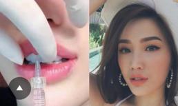  Nữ ca sĩ Bảo Thy lên tiếng về tin đồn đi tiêm môi
