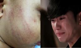 Nhìn dấu vết lạ trên má con trai tôi tức giận hủy đám cưới với người vợ thứ 2 ngay lập tức