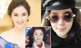 Hoa hậu Nguyễn Thị Huyền lên tiếng về tin đồn phẫu thuật thẩm mỹ