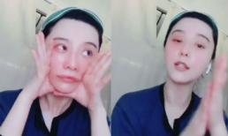 Phát hoảng với khuôn mặt đỏ ửng kinh dị vì mát-xa của Phạm Băng Băng