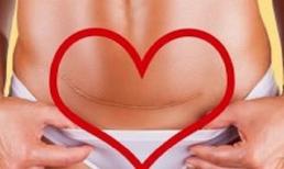 3 sự thật về sinh mổ bắt buộc những mẹ bầu nào có ý định phải biết